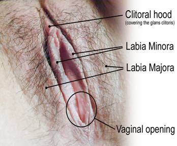 vulvodynia